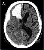Arch Neurosci